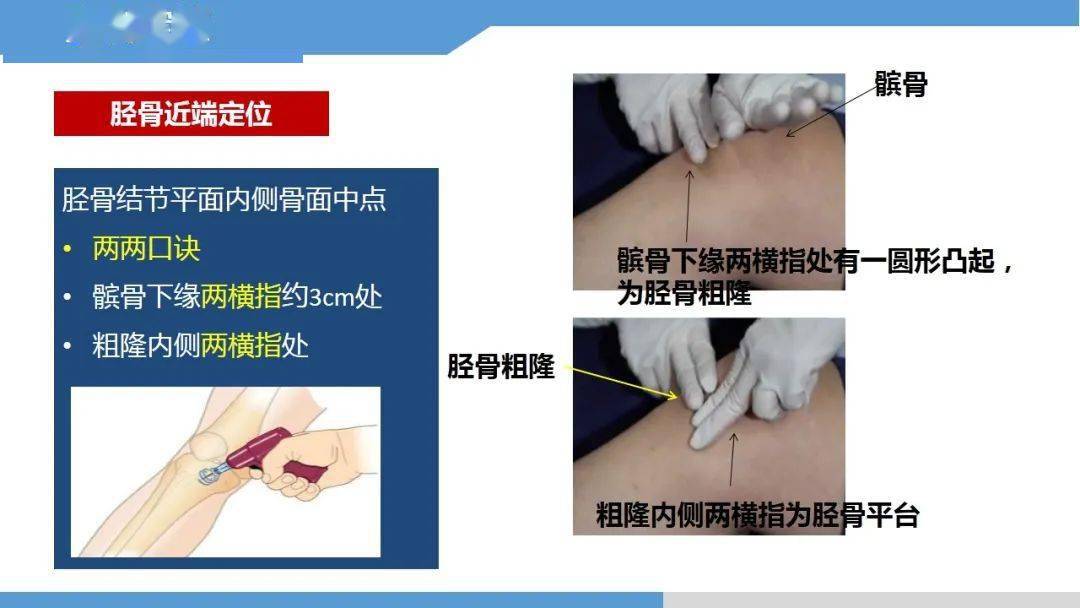 【ppt】永不塌陷的生命通路-骨髓腔输液技术_护理_微信_中卫