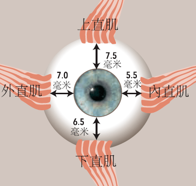由于大多数人的巩膜鼻侧曲率较平的关系