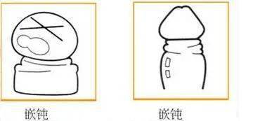 包皮被翻开后,狭窄的包皮口形成紧束的环,紧紧地箍住小jj.