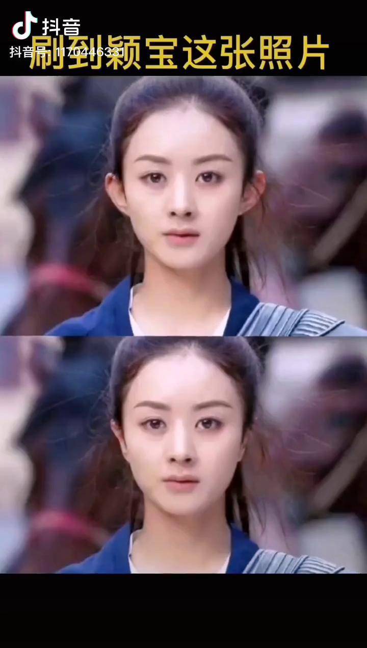 刷到颖宝这组照片时才知道我的贴面耳有jiu了精灵耳耳贴招风耳好物