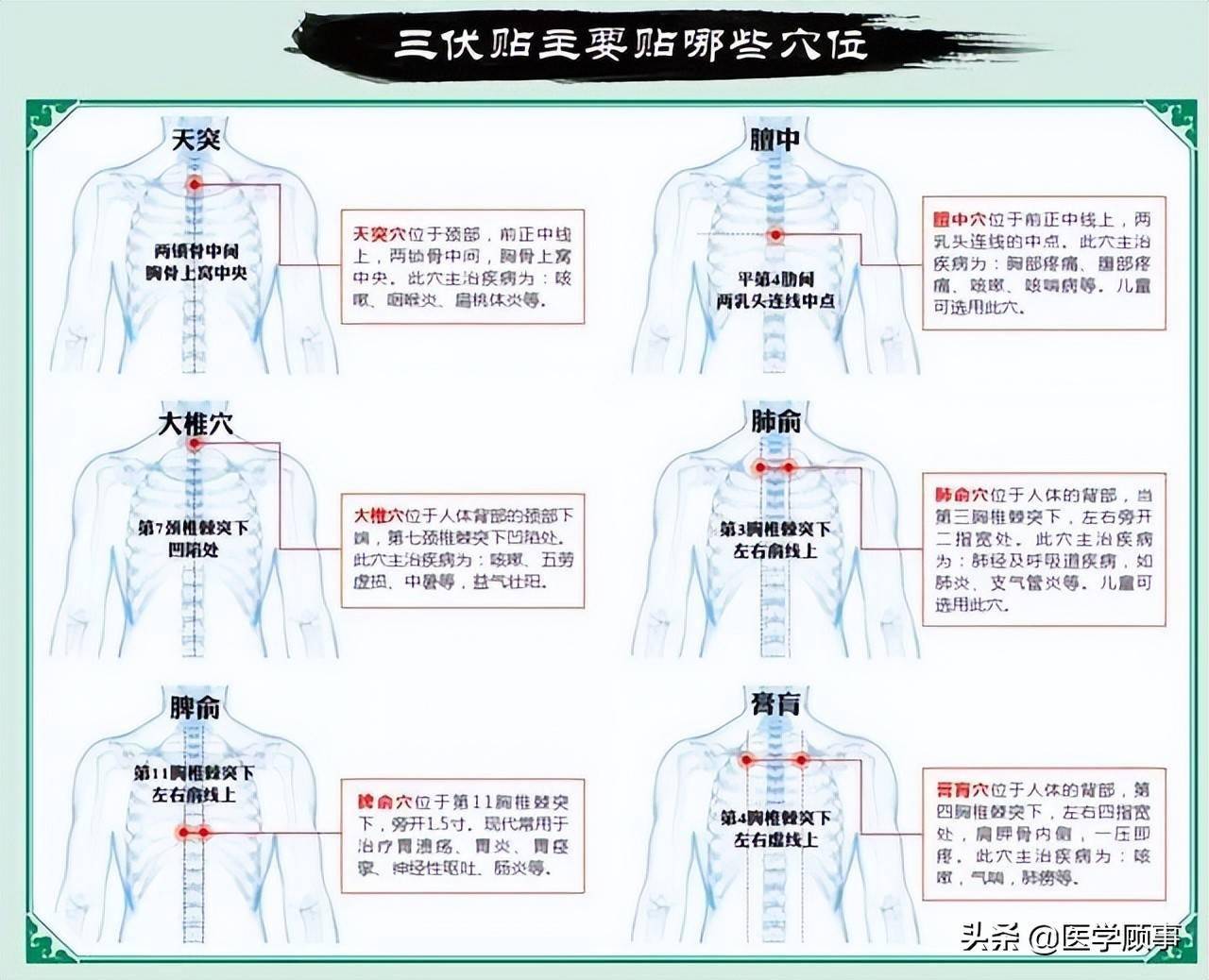 特别说明 三伏贴贴敷的适应症主要有 支气管哮喘