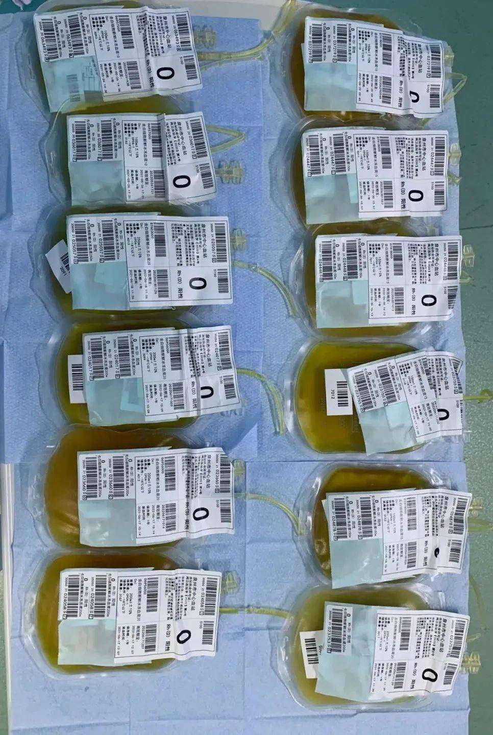 考虑患者重度肝损伤,胆酶分离,病情仍重,有血浆置换治疗适应症,经与