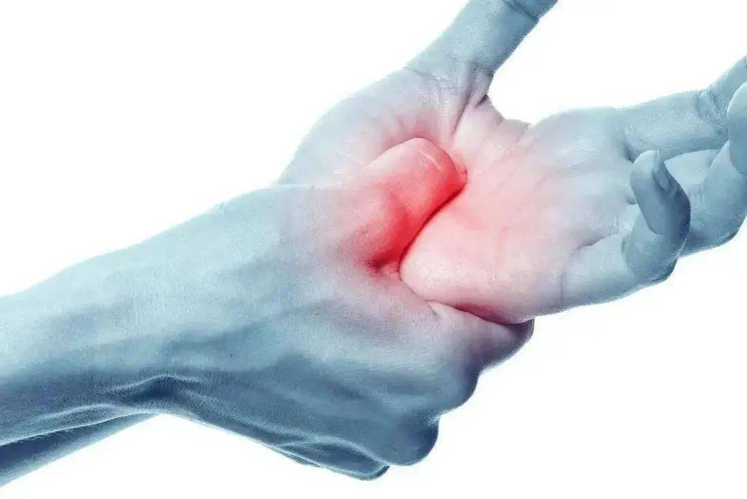 【健康科普】腱鞘炎，您了解吗？