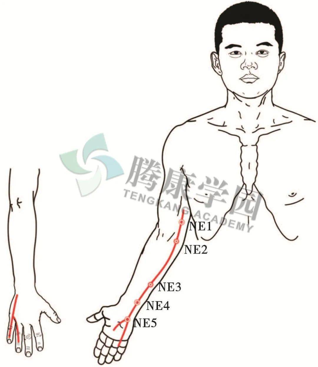 ne1:struthers 弓.ne2:肘尺管.ne3:穿过尺侧腕屈肌腱和尺骨之间.