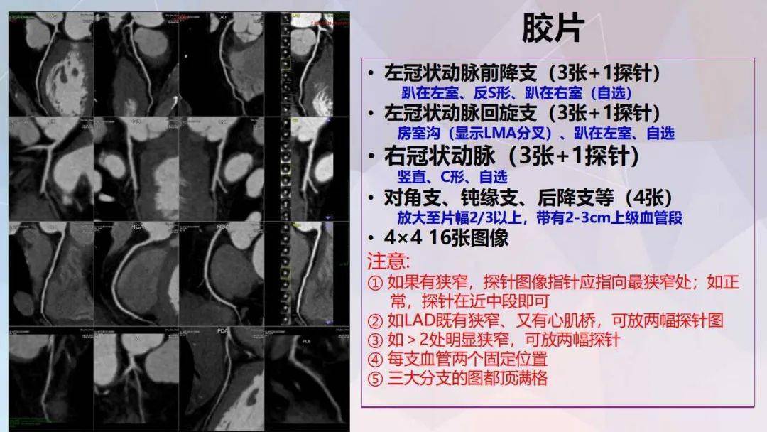 冠脈及胸痛三聯cta重建規範及報告模板