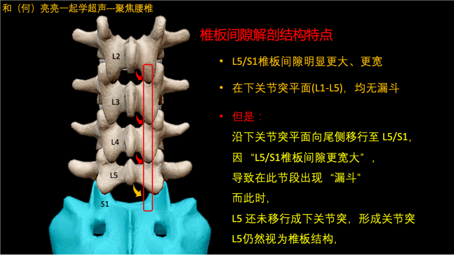 l5/s1椎间盘位置图图片