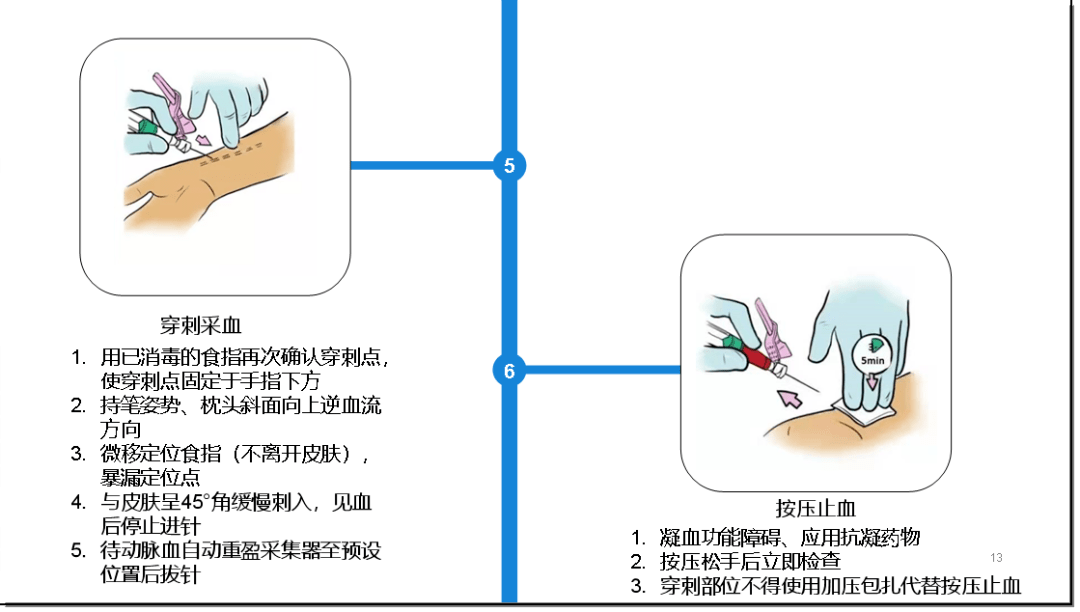 小儿桡动脉采血图片