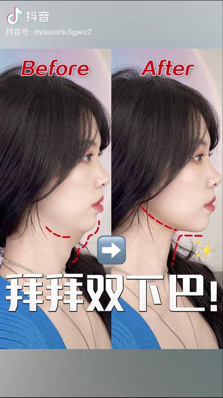 拜拜双下巴!2招get明星同款精致下颌线双下巴消失术 下颌线