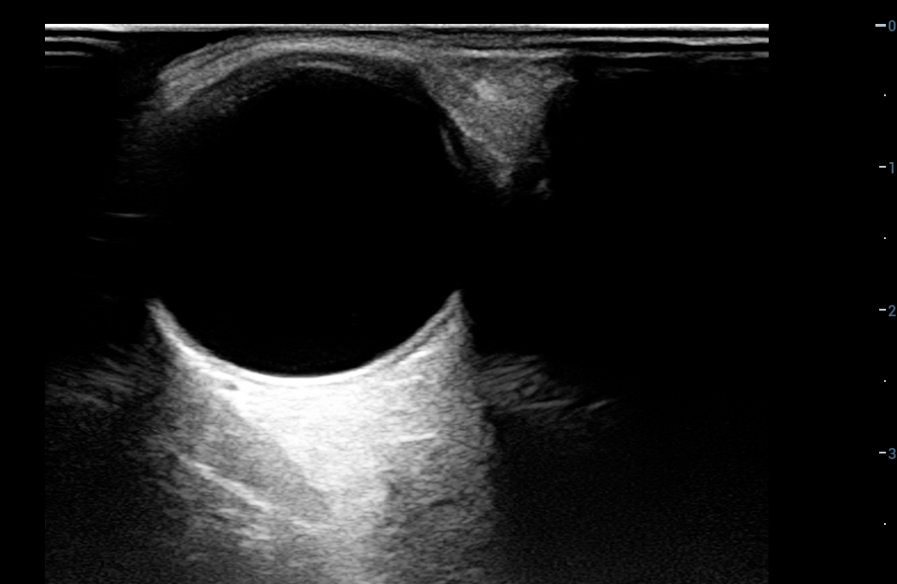 【眼部超声系列二】 眼部超声基础切面