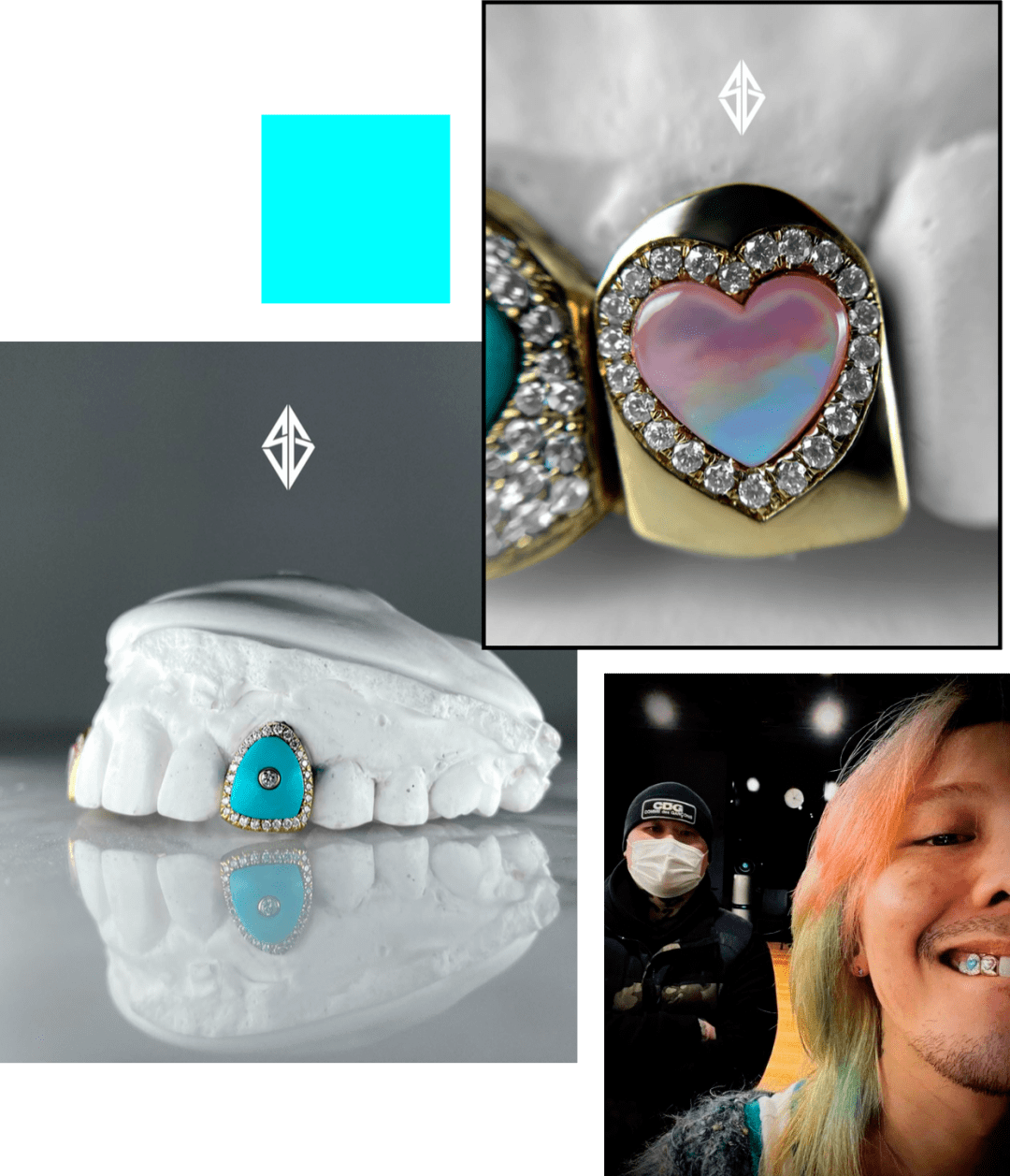 钻石_牙齿_配饰