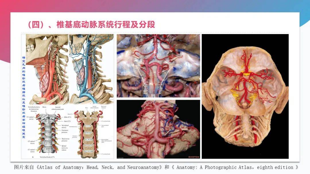 最直觀的腦血管解剖圖_異議_立場_網站