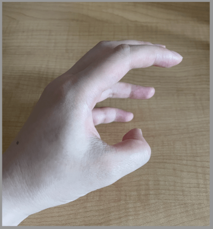 "气到中毒"是怎么回事?_碳酸_父母_患者