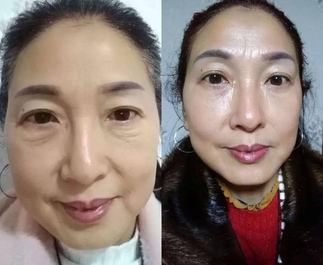 40岁女人不长"眼袋",竟然是因为做了这件事……_蜂王浆_效果_问题