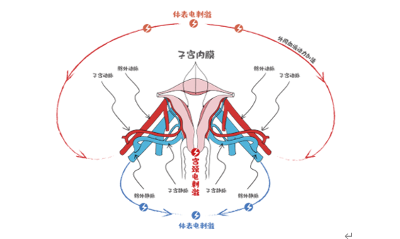 針對薄型子宮內膜,反覆種植失敗,宮腔積液等進行輔助治療;對婦科針對