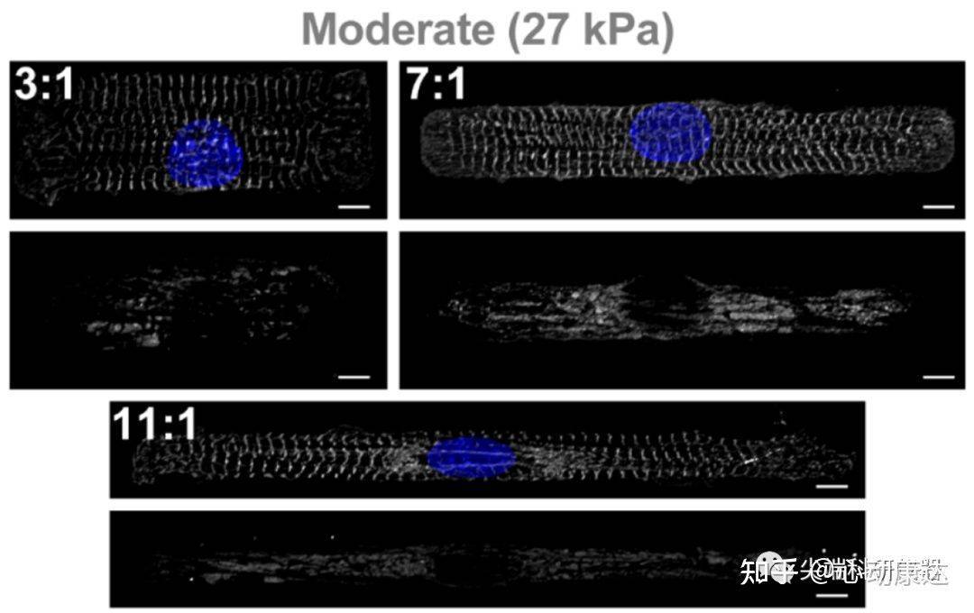 j mol cell cardiol:心肌细胞的线粒体结构取决于心肌细胞形态和胞外