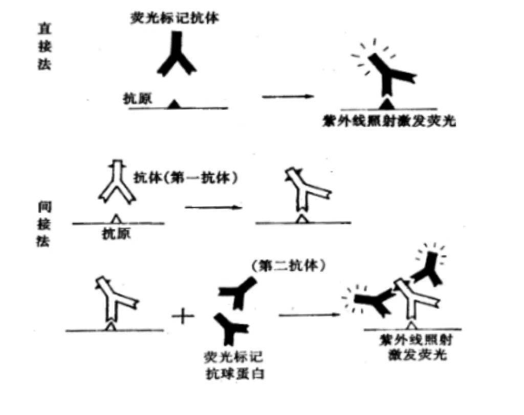 自身免疫病的診斷自身抗體(抗核抗體,抗平滑肌抗體,抗線粒體抗體)