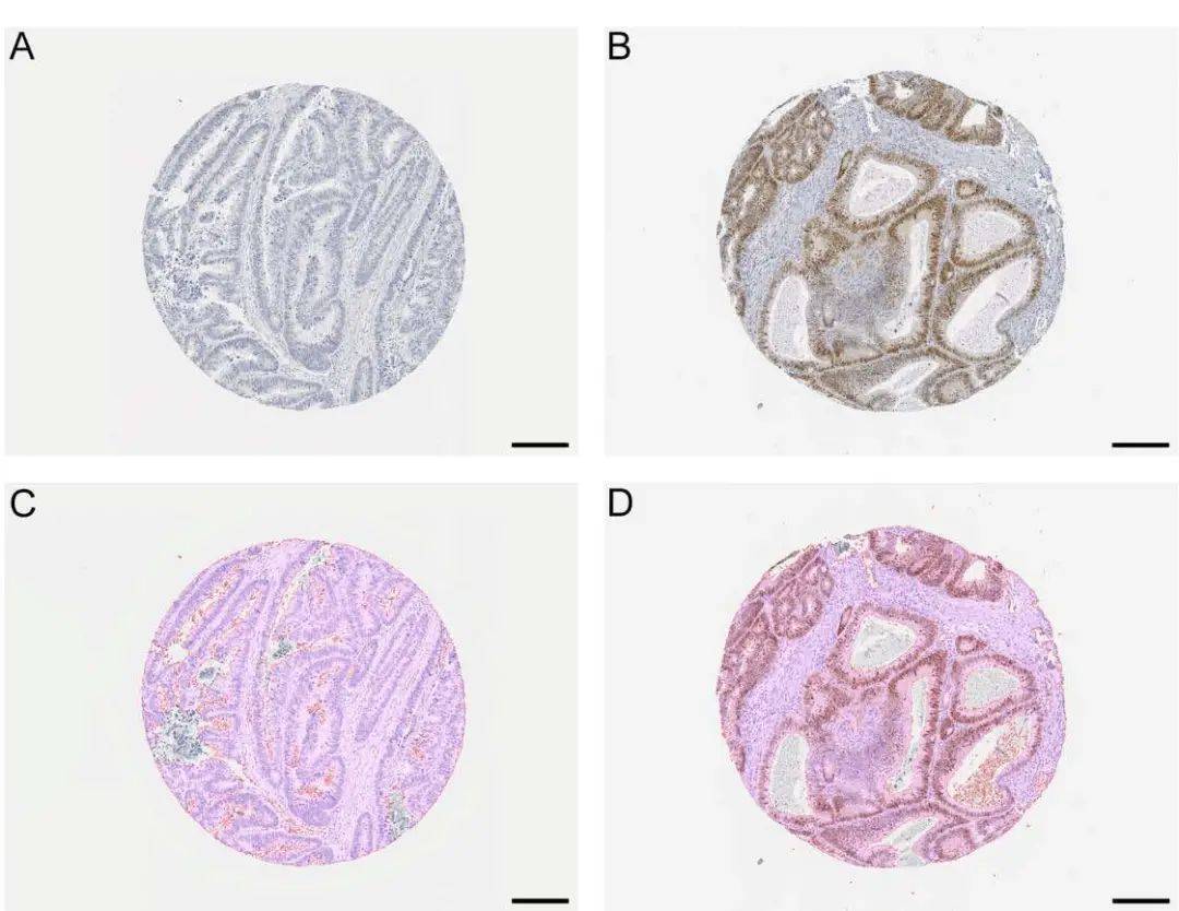 sox2阳性细胞识别和量化分析图图中为dab染色强度(x轴)与苏木素染色