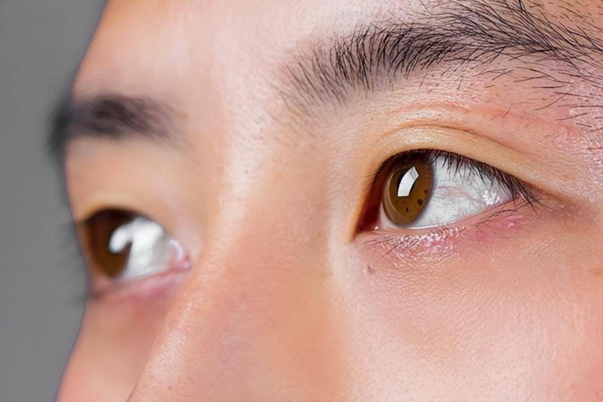 枸杞有着"明眼子"的美名,具有一定的明目功效.