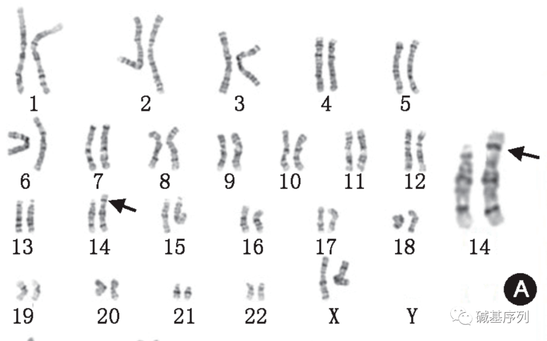 14号染色体图片