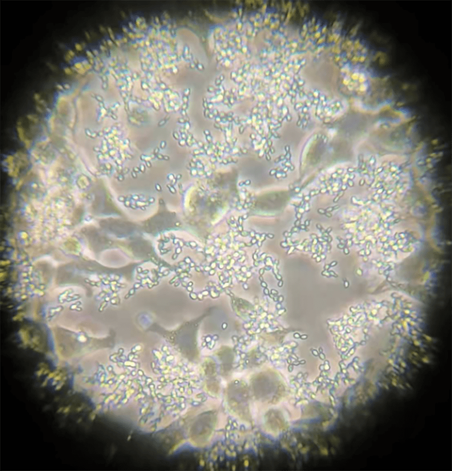 制霉菌素结构式图片