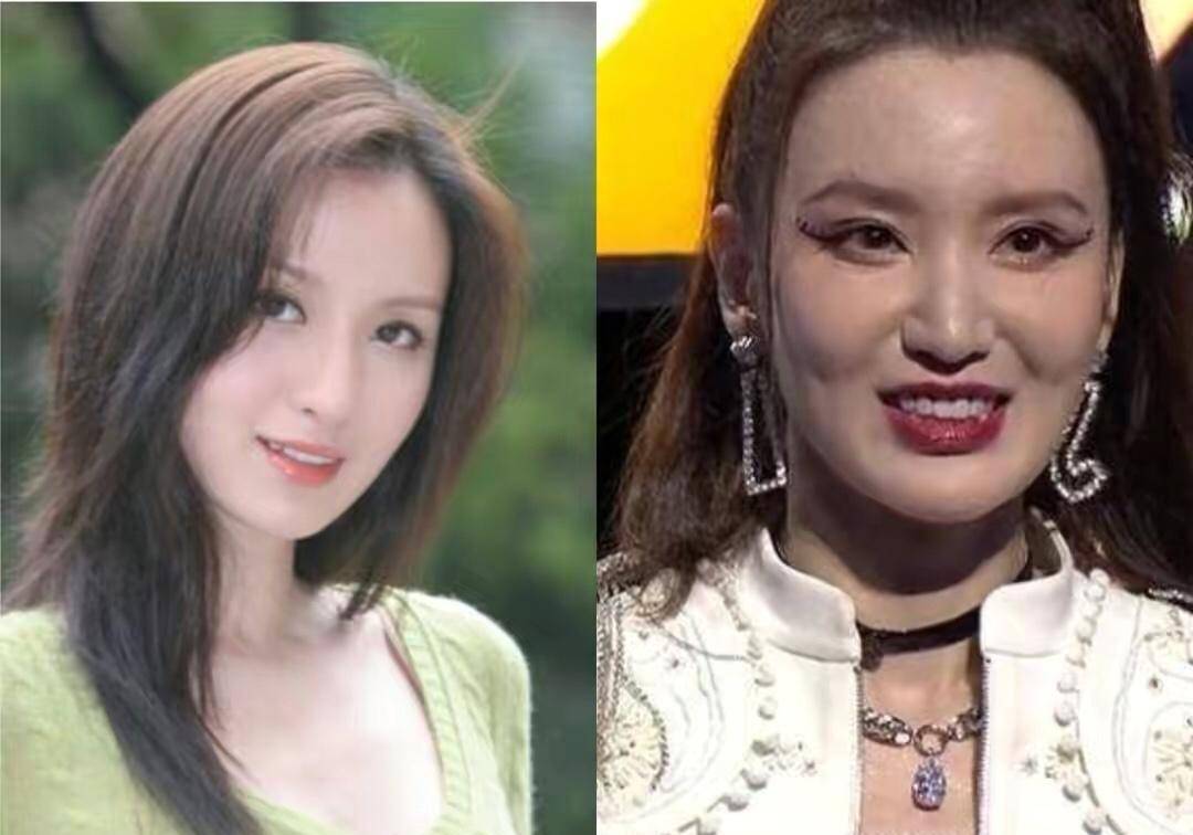 嘴歪,脸肿,表情僵硬,让实力派女星们陷入"中年危机",太可惜_面部_张萌