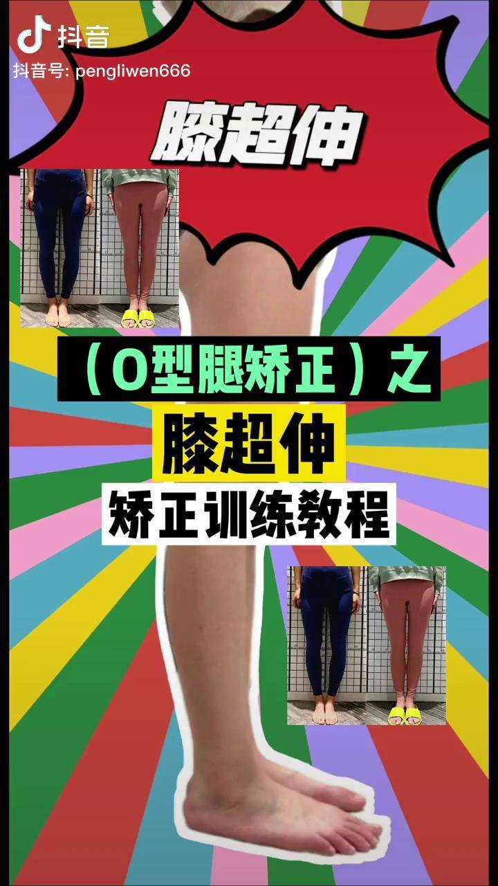 【膝超伸】矫正训练教程!