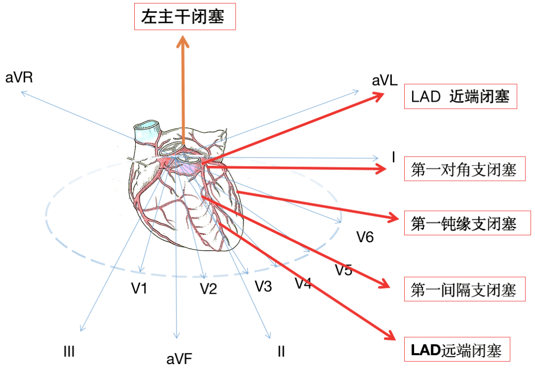 左回旋支纤细图片