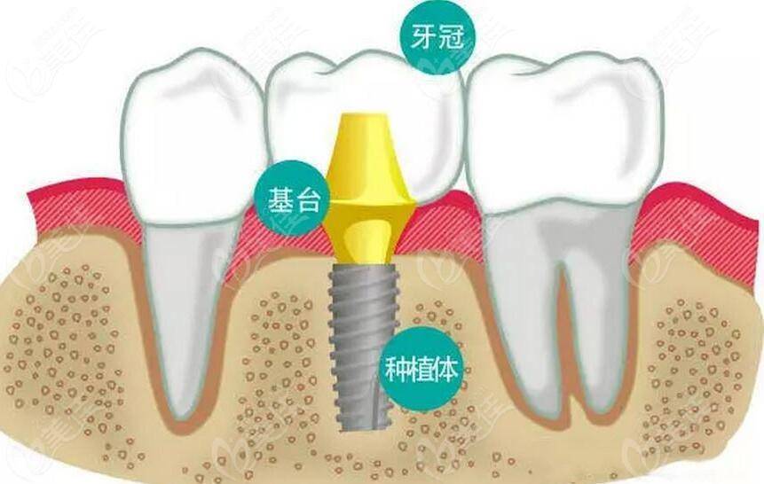 箭在弦上发布会视频