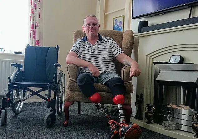 2008年,他决定接受截肢手术,从此他失去了双腿.