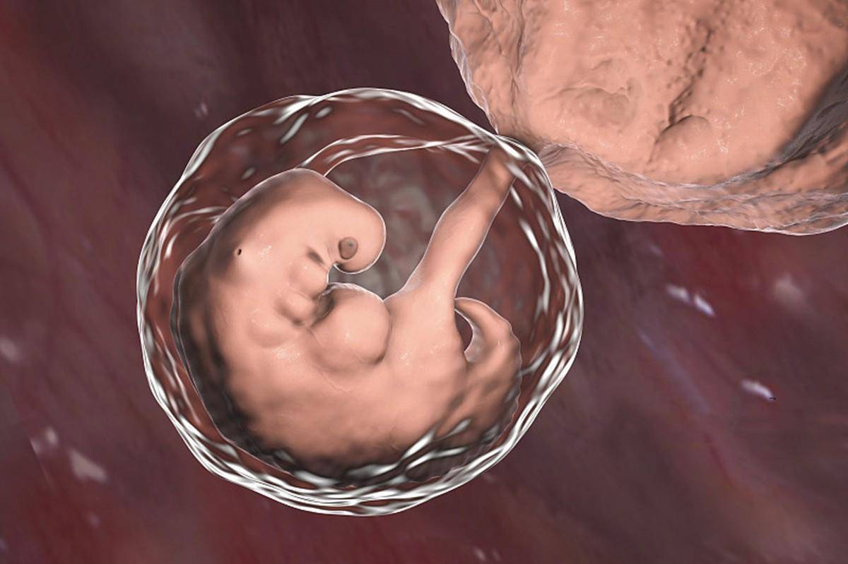 孕早期孕吐反应突然消失是不是胎停？胎停育的原因可能和这几方面有关,孕妈