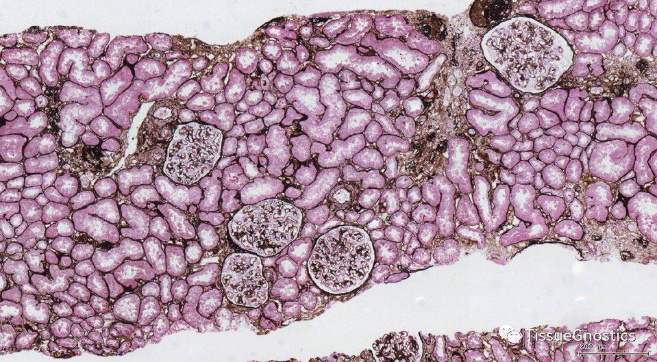 肾脏活检组织pasm染色定量分析实例_识别_进行_实验