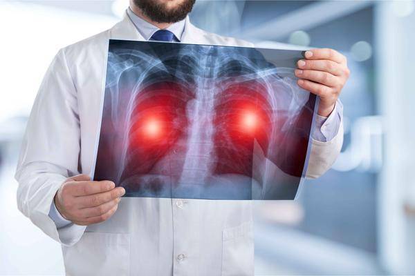 原创
            肺结节会发展为肺癌？提醒：想要防止其恶化，患者需做好这4件事
                
                 