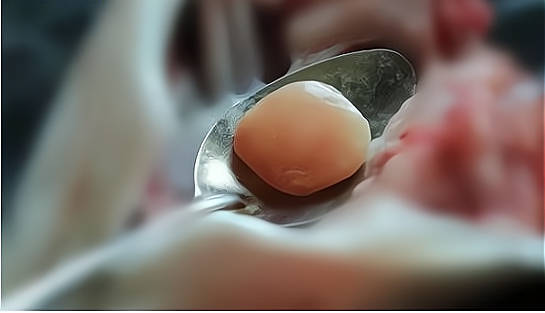 在农村买了一条30多斤的青鱼,发现有块青鱼石,如何把它取出来呢?