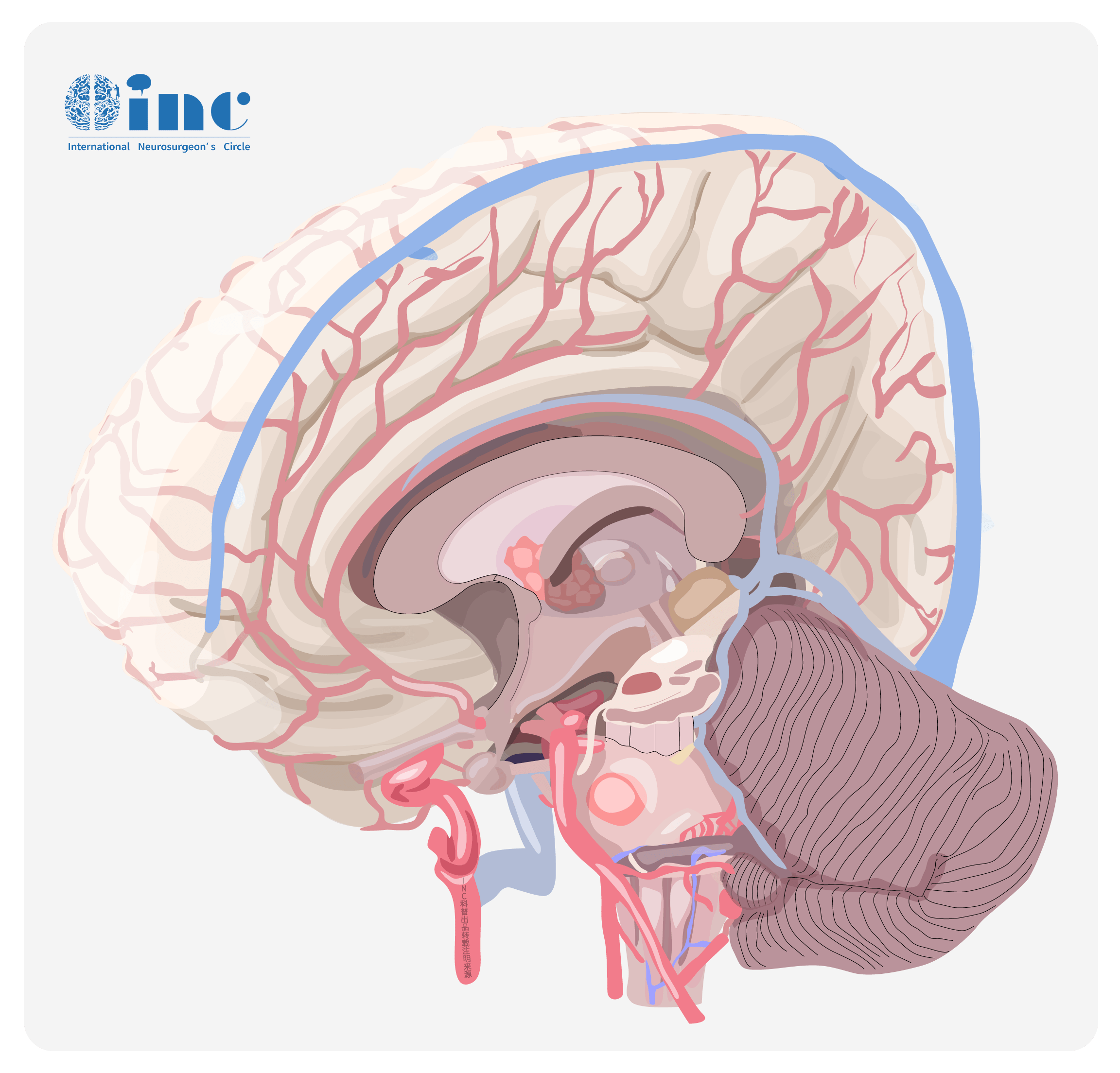 脑干内部超详细功能解剖图，病损表现及定位诊断_医学界-助力医生临床决策和职业成长