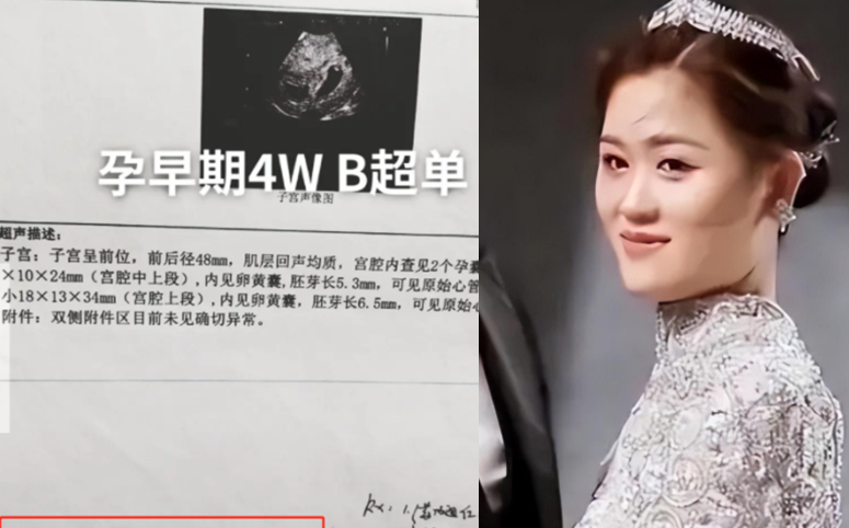 恭喜!陈萌晒b超照宣布怀双胞胎,忙着筹备婚礼,大衣哥默许带货