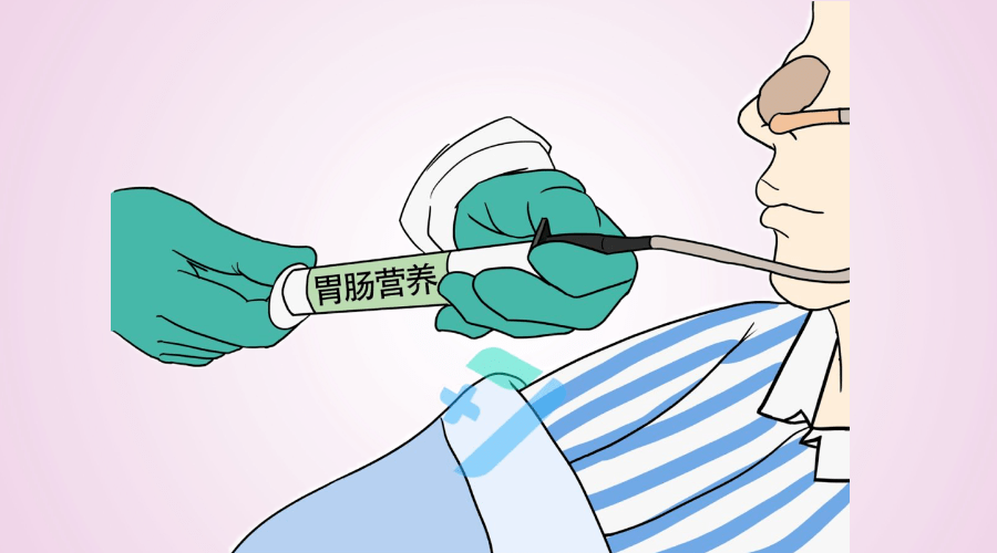 鼻饲就是"鼻饲法",在特殊情况下人工把胃管经鼻腔置入食道中,先把食物