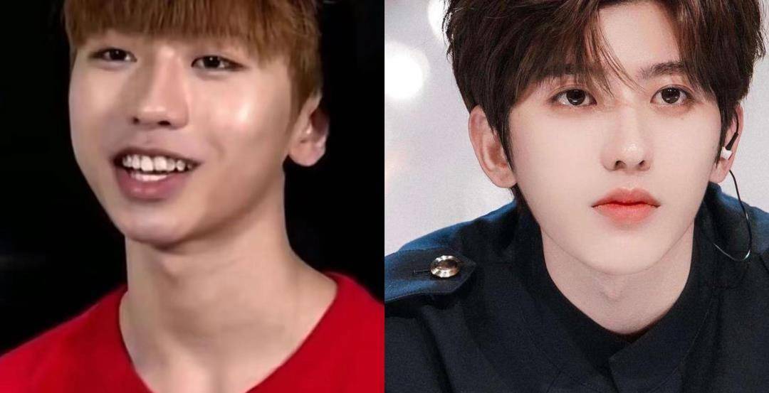 明星动下巴千奇百怪,李小璐又尖又翘,孙菲菲不愿照镜子_蔡徐坤_变化