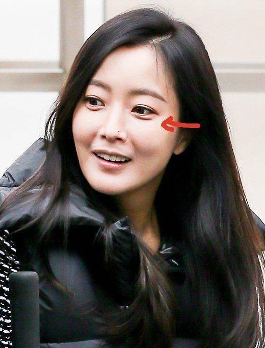 肉感的小脸也遮不住法令纹问题了,稍微做点表情就格外明显,嘴巴歪得也