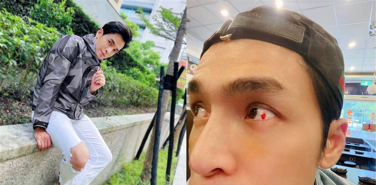 男星蔡东威惊爆多病缠身急摘11颗瘤,医生警告:恐心肌梗塞_gino_戏剧