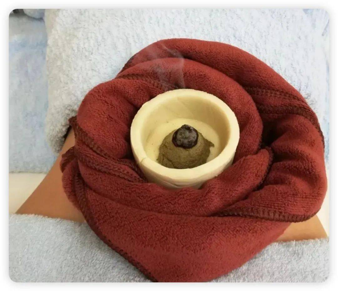 了不起的中医 | 小小"面碗"也能治病_经络_陈女士_治疗