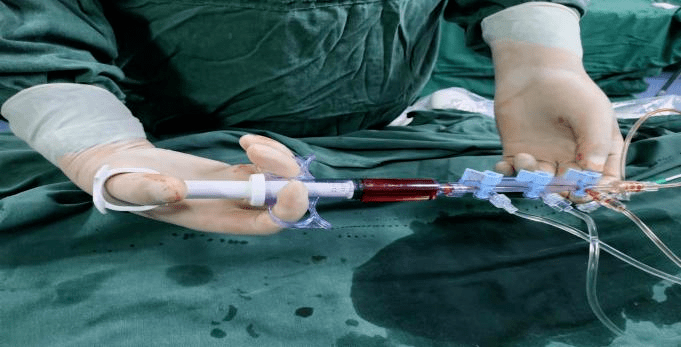 造影导管到达冠脉口后,连接造影导管与三联三通,三联三通分别连接压力