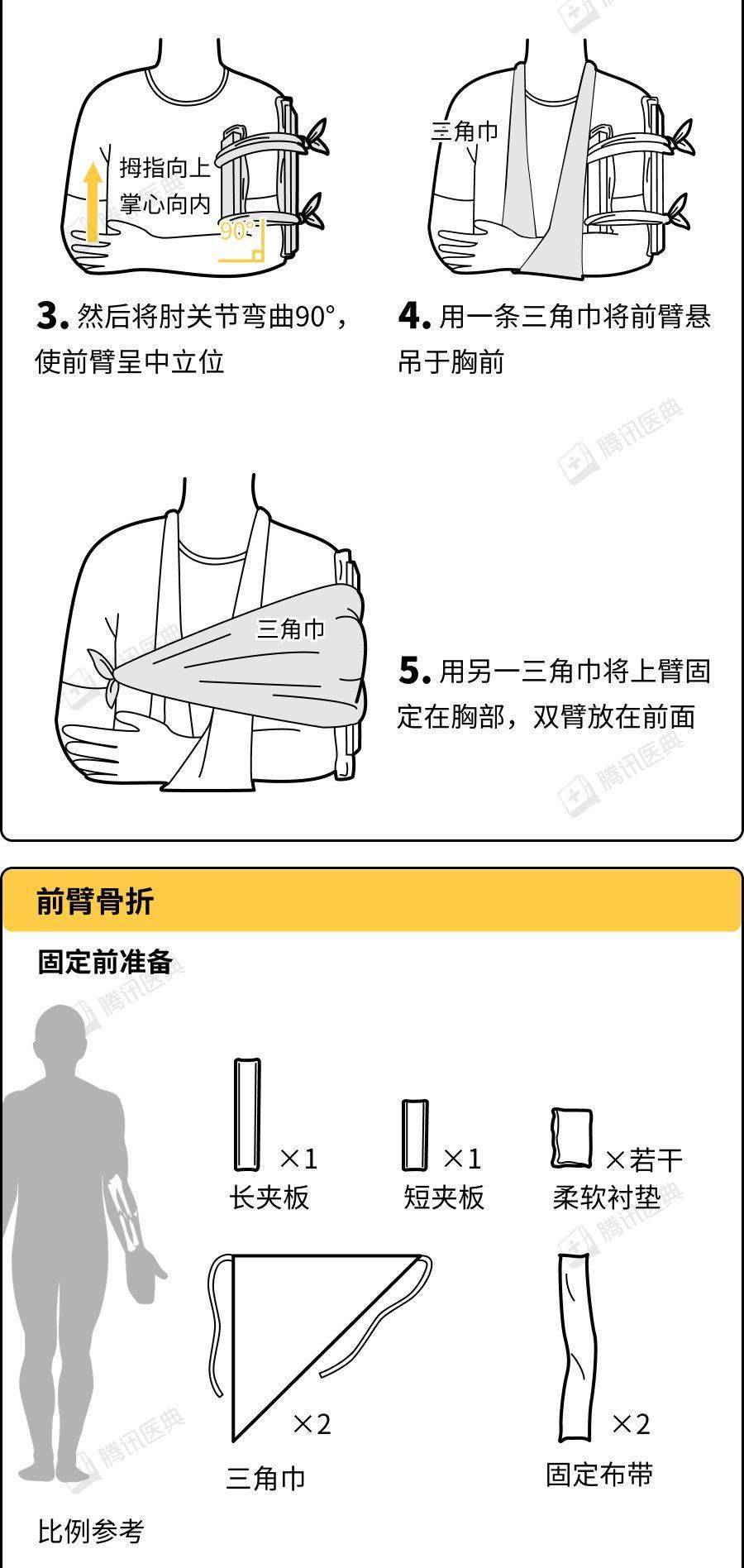 一图读懂骨折急救固定技术!