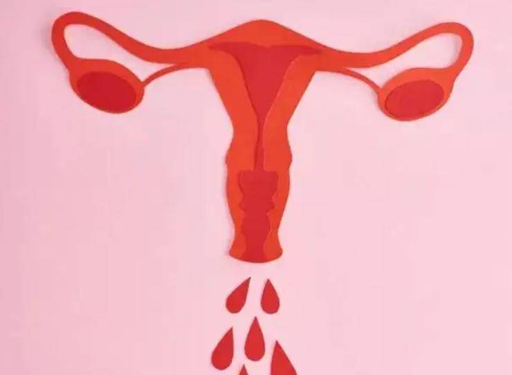 分泌期的子宫内膜海绵状功能层从基底层崩解脱落,随着血液,宫颈粘液