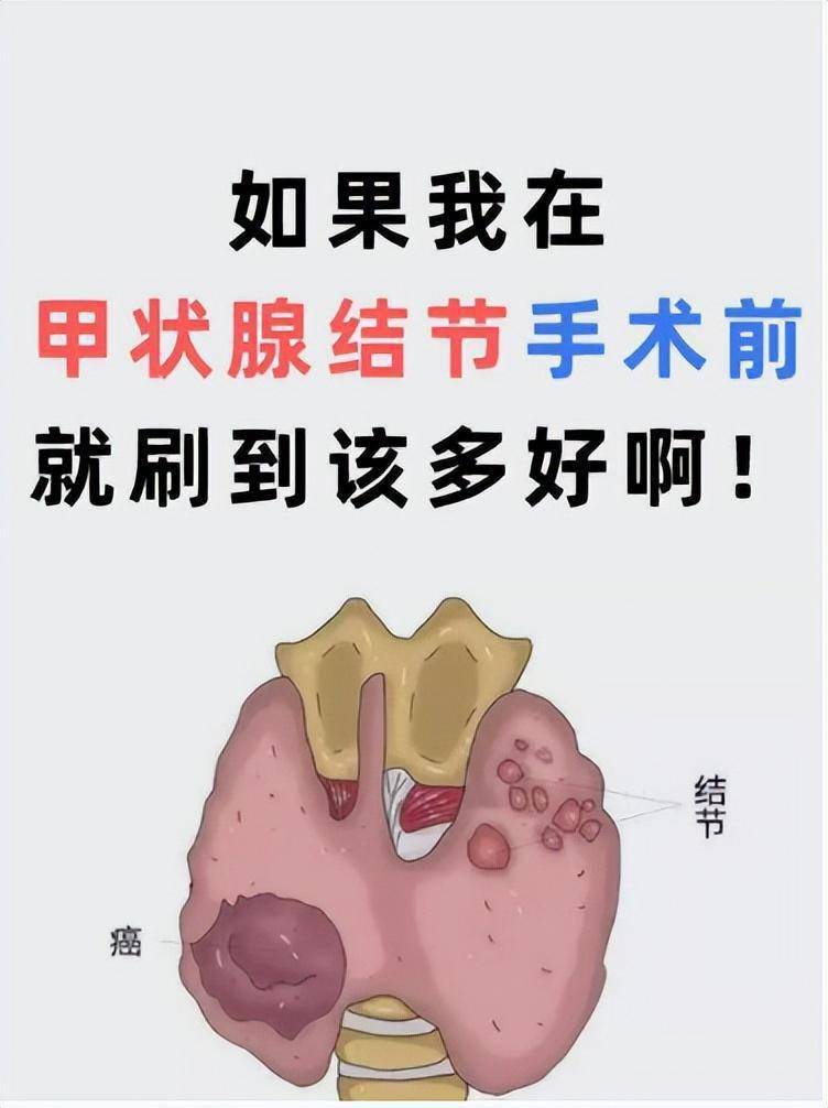 甲状腺挂号挂什么科(甲状腺挂号挂什么科室的号)