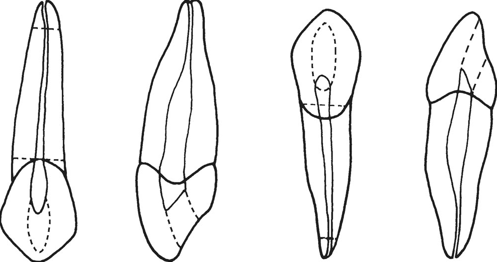 3mm,根尖孔至解剖根尖距離為0.35mm.