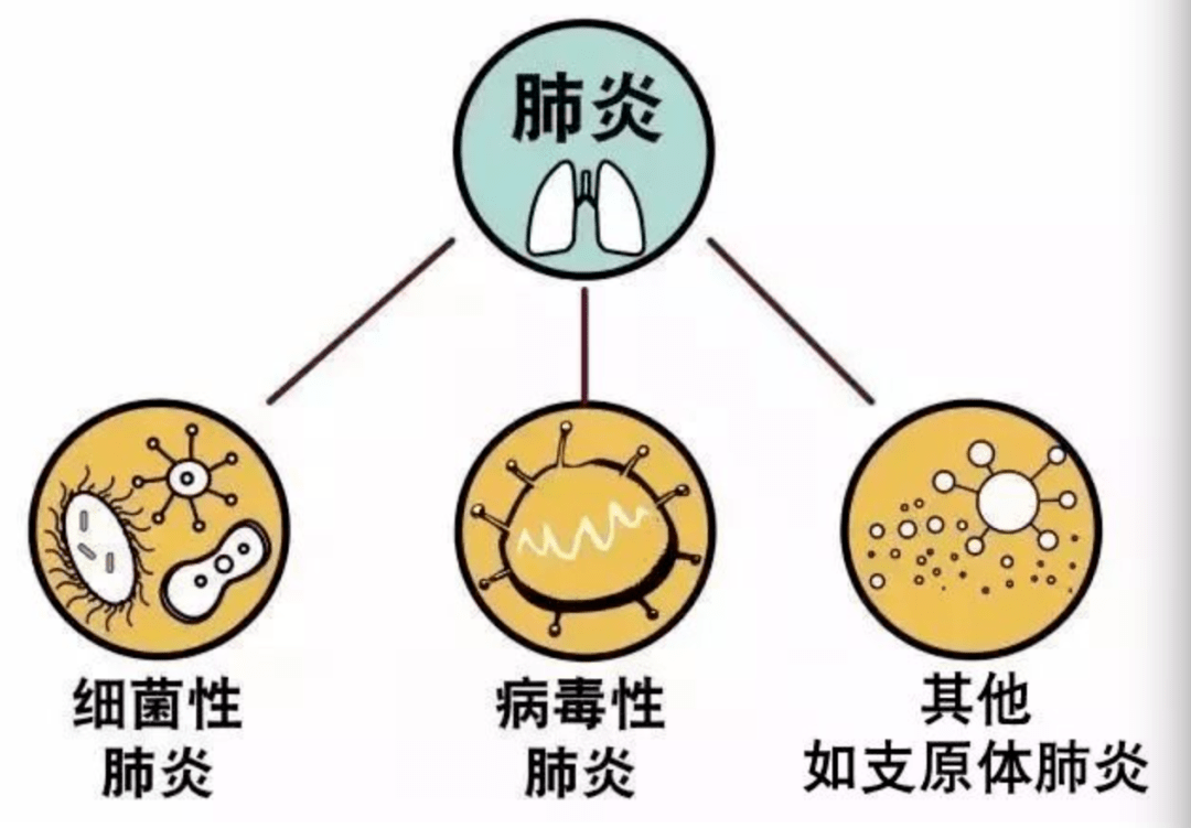 世界肺炎日 | 关注儿童肺炎 保护儿童健康_症状_声音_病原