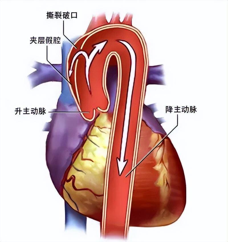 主动脉走向示意图图片