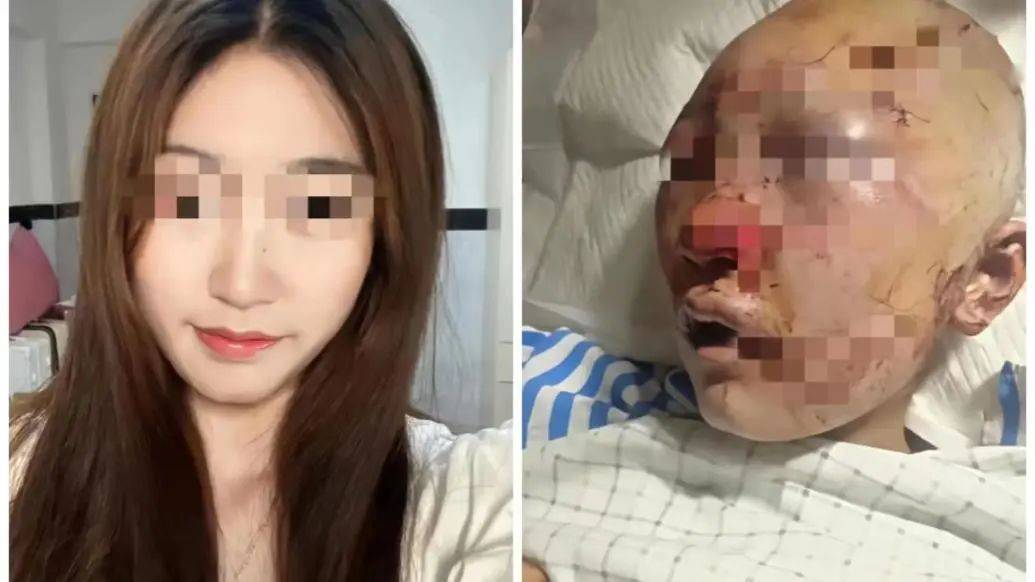 "女孩上公厕被打"最新进展|施暴男父亲称其"精神不正常"_俞某_徐某和