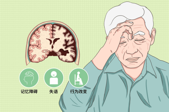 药物治疗到底有没有必要?你真的了解吗_生活_患者_阿尔茨海默