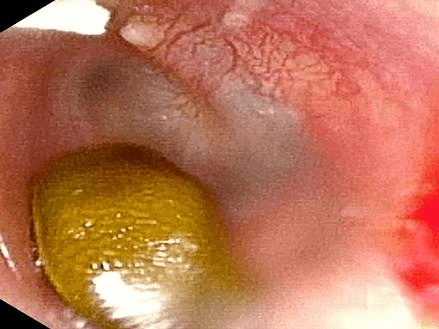 鼻腔_soogif_耳道